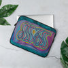 Coque Pour Ordinateur Portable Calligraphie Arabe Alhamdulillah (Reconnaissance)